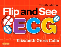 cover image - Flip and See ECG, 4th Edition