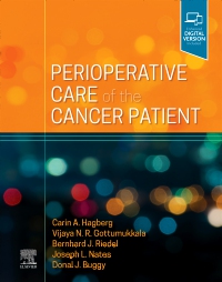 cover image - Perioperative Care of the Cancer Patient, 1st Edition