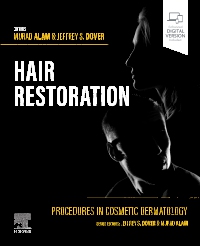 cover image - Procedures in Cosmetic Dermatology: Hair Restoration, 1st Edition
