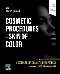 cover image - Procedures in Cosmetic Dermatology: Cosmetic Procedures in Skin of Color, 1st Edition