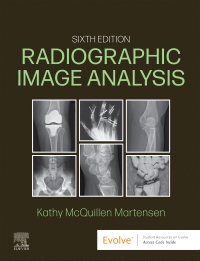 cover image - Evolve Resources for Radiographic Image Analysis, 6th Edition